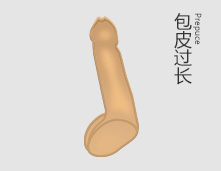 包皮