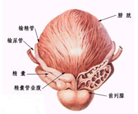 前列腺痛